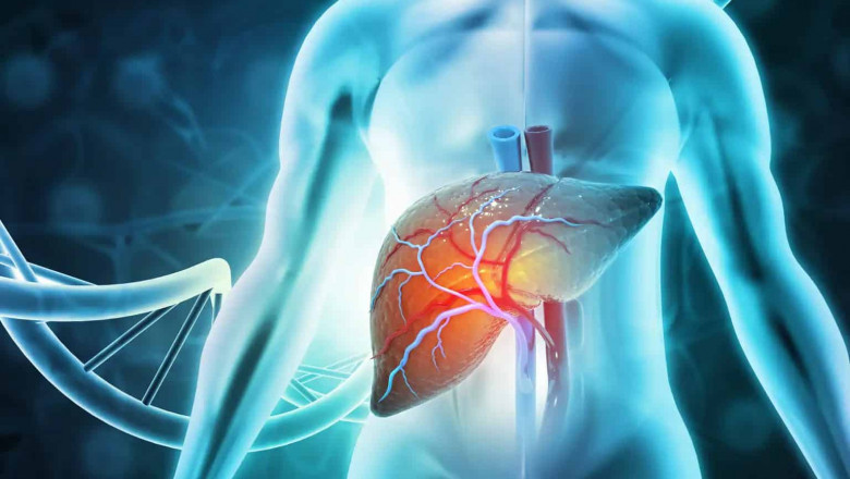 How to Interpret Liver Ultrasound Results Alongside Blood Tests