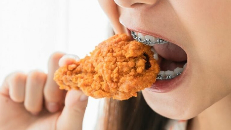 Foods to Avoid During Your Clear Aligner Journey