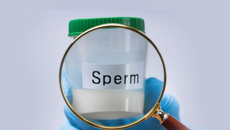 What Is The Molecular Biology Of A Sperm?