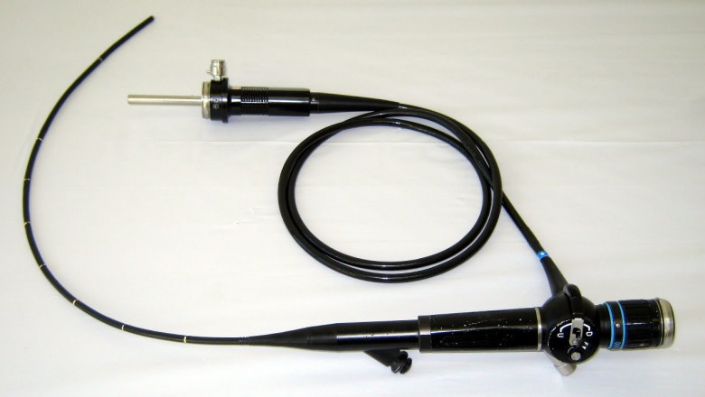 "A Decade of Growth: Ultrasound Endoscope Market Trends and Opportunities (2021–2031)"