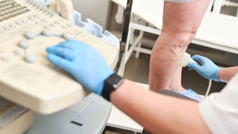 Elite Vein Centers: Leading Care for Your Health