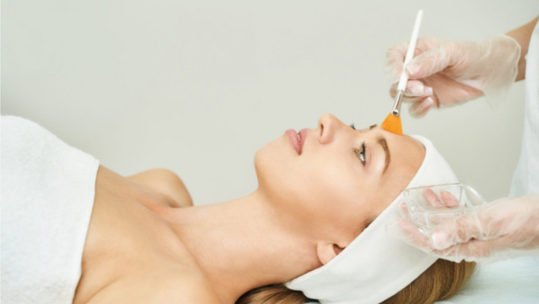 What Happens During a Chemical Peel in Islamabad?