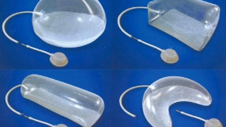 North America Extremity Tissue Expanders Market
