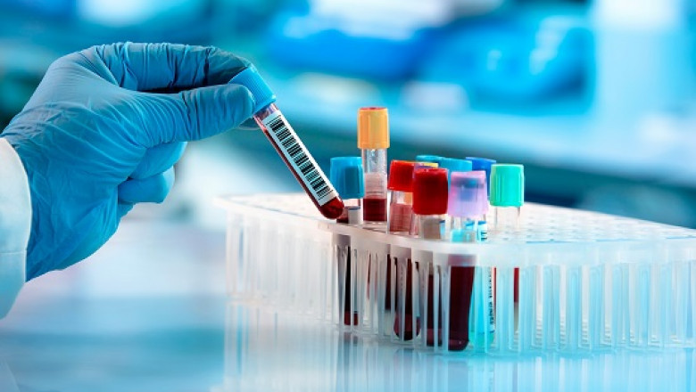 Clinical Laboratory Tests Market: Driving Diagnostic Innovation and Healthcare Efficiency
