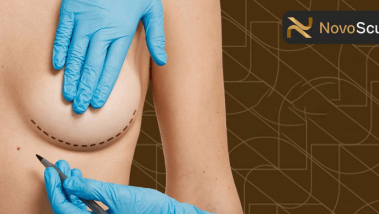 Safe Liposuction Alternatives for Busy Professionals: Minimal Downtime, Maximum Results