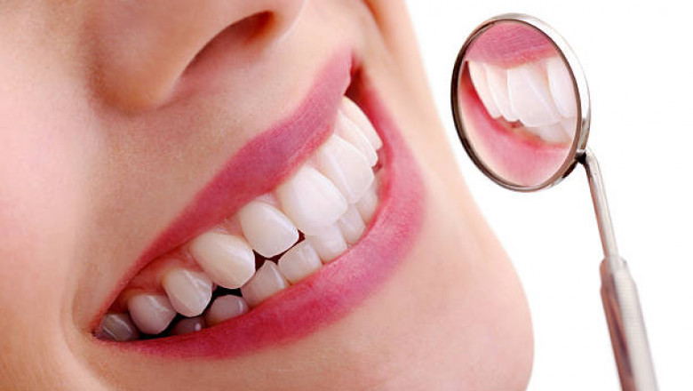 Teeth Whitening in Riyadh’s Luxury Clinics: Aesthetic Dentistry Meets Spa-Like Experiences