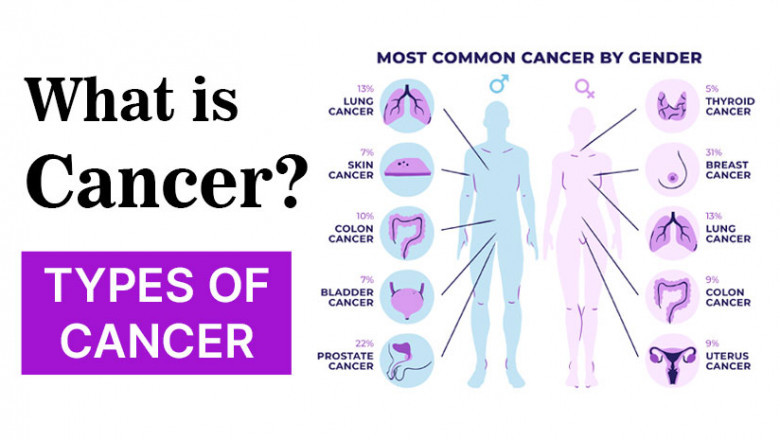 What Is Cancer? Awareness of Top 10 Cancer Symptoms &amp; Types