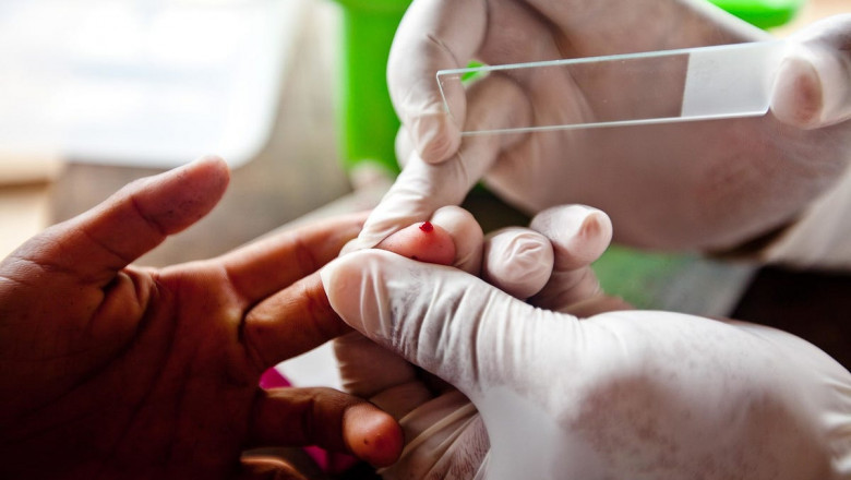 Malaria Diagnostics Market: Challenges and Opportunities