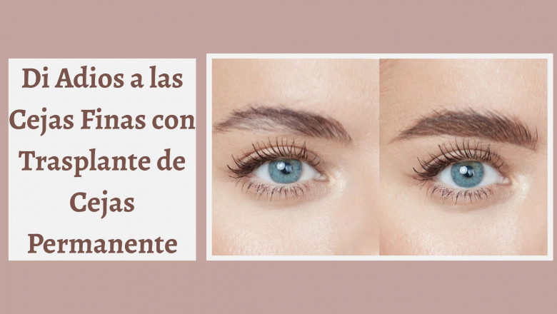 Di Adios a las Cejas Finas con Trasplante de Cejas Permanente