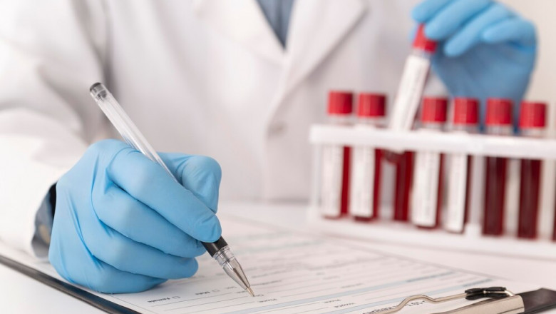 Can you get tested for STDs at home?