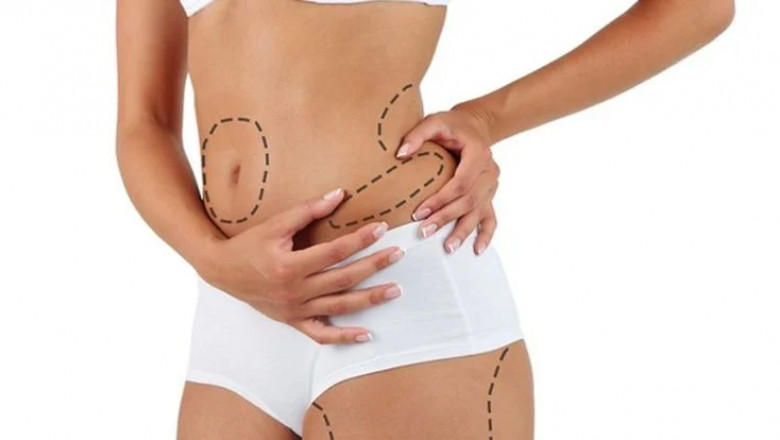 The Cost of Liposuction in Dubai: A Breakdown of Pricing and What You Should Know