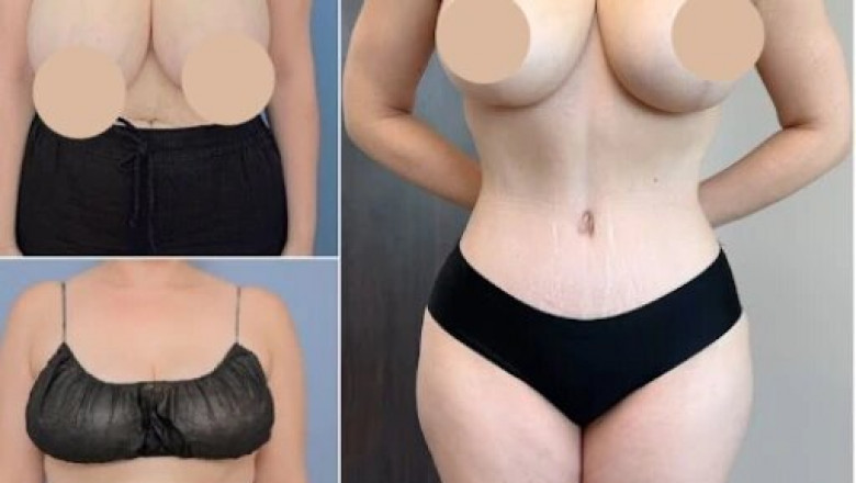 The Science Behind Body Contouring in Dubai