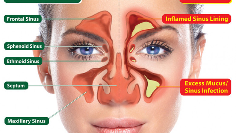Feeling Dizzy? Your Sinuses Might Be to Blame—Here’s Why