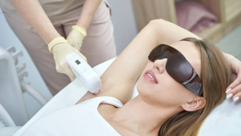The Science of Smooth: Dermatologist-Backed Laser Hair Removal Gaining Trust