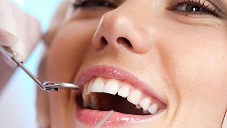 Dental Implants in Tampa: A Comprehensive Guide to Restoring Your Smile