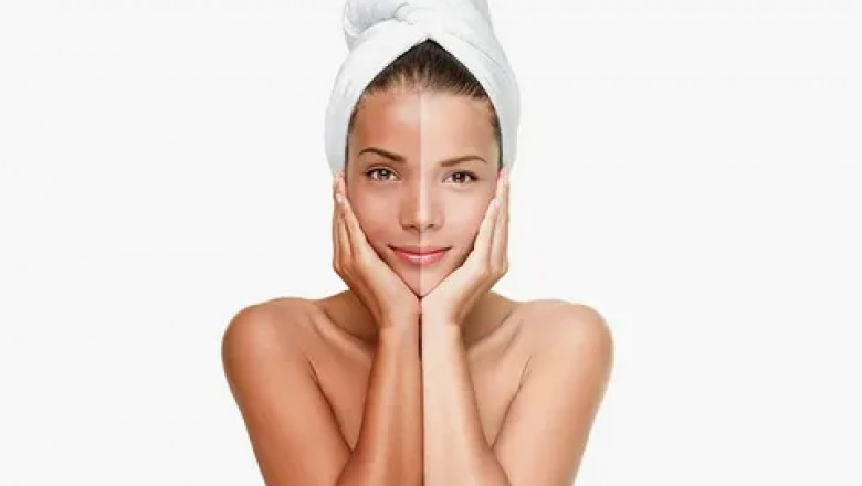 Skin Whitening in Islamabad: What Works for Oily Skin?