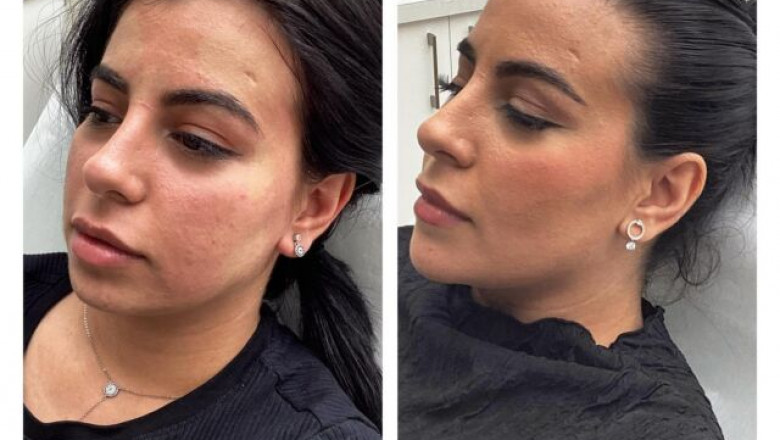 Your Best Skin Why a Richmond Skin Clinic is Your Beauty Ally