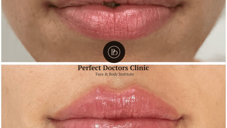 Can Dermal fillers treatment in Dubai Be Combined with Other Procedures?
