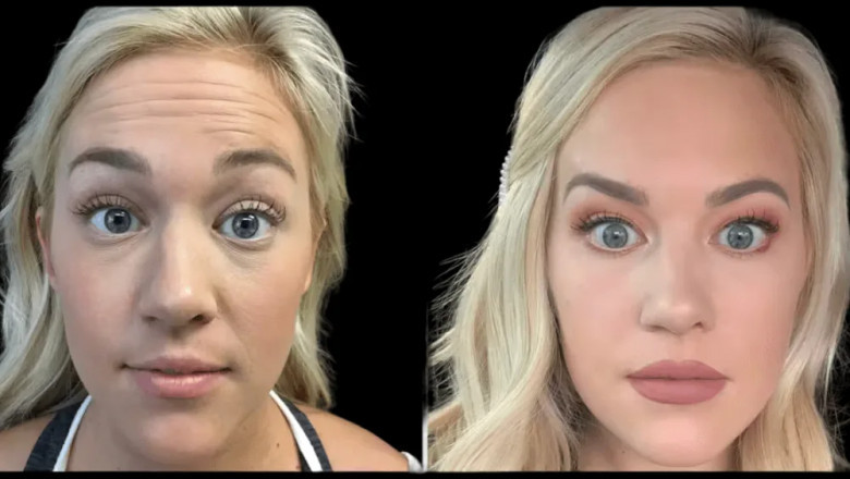 Secrets to Ageless Skin from the Best Doctors in dubai Using Botox
