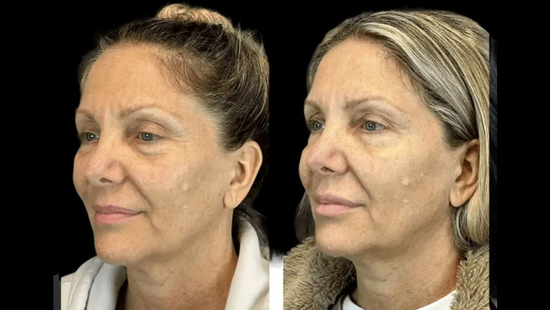 Inside a Celebrity Experience at the Best Aesthetic Clinic in Dubai