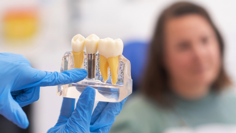 Pediatric Considerations: When Are Dental Implants an Option?