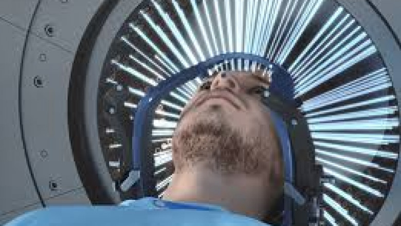 Gamma Knife Radiosurgery in India: Advanced Brain Treatment with Precision and Care