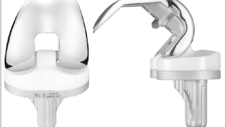 Tibial insert Market Report Covers Future Trends With Research 2025 to 2033