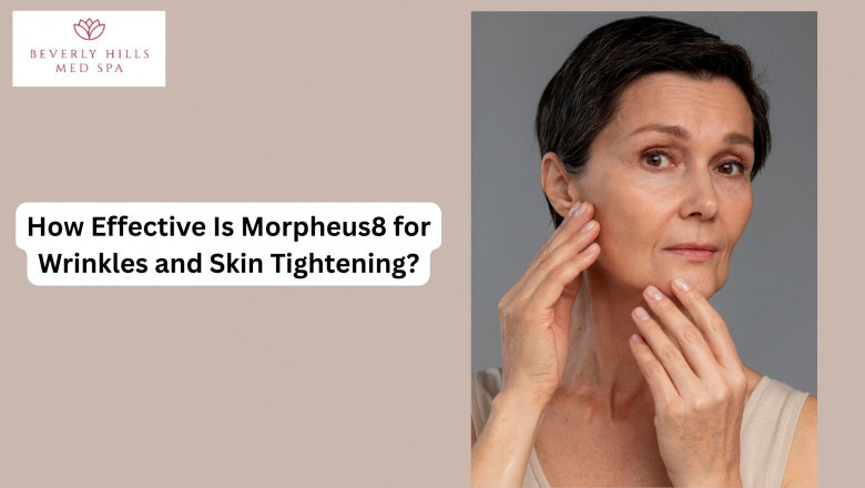 How Effective Is Morpheus8 for Wrinkles and Skin Tightening?
