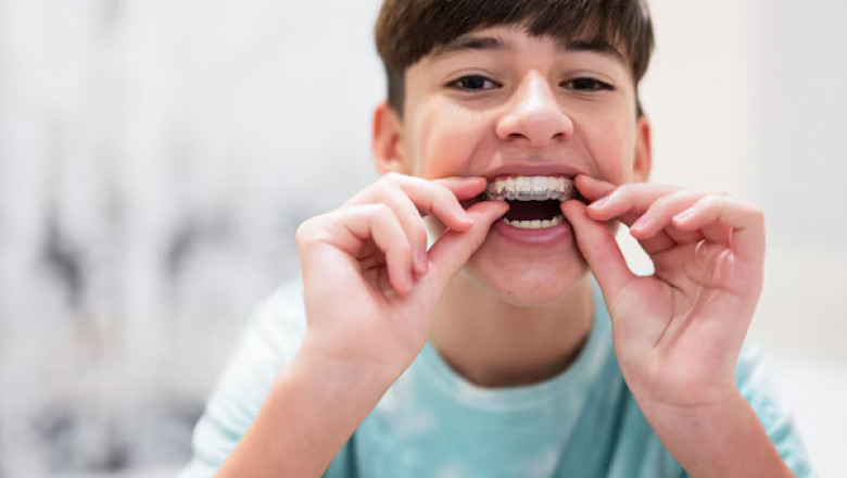Ensure Reliable Results: What to Know About Licensed Invisalign Dentists in Hiram