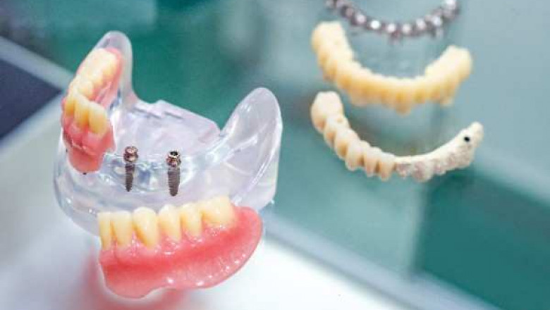 Trusted Local Care for Healthy Smiles in Beverley