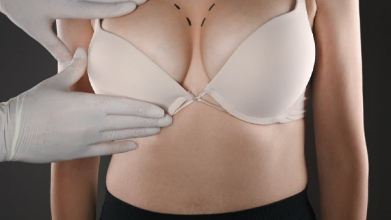 Best Doctors in Dubai on Combining Breast Augmentation with a Lift