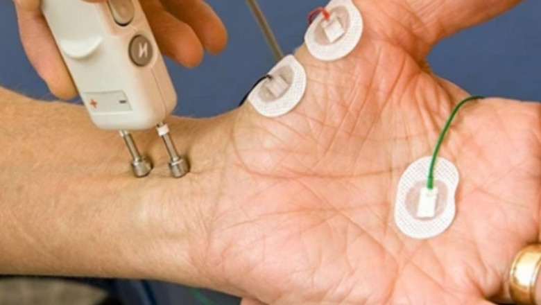 NCV Test Price Guide Find Affordable Rates Near You