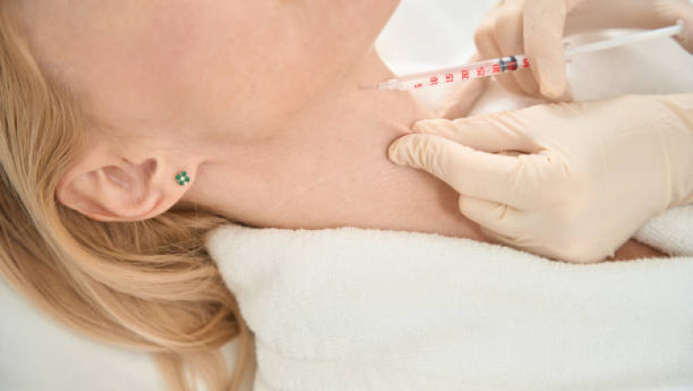 The Complete Guide to Laser Hair Removal in Toronto