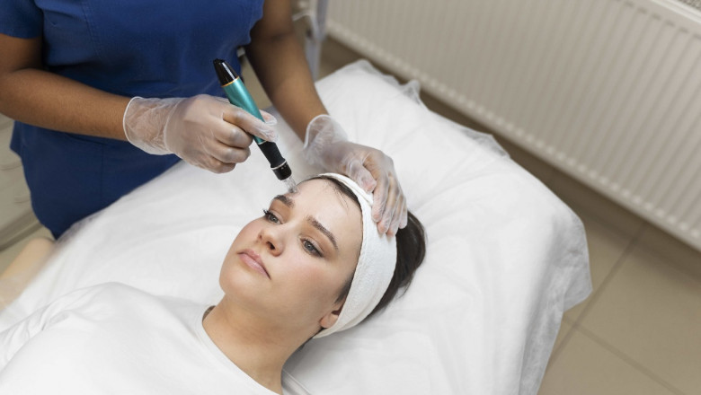 How to Choose the Best Botox in Mississauga