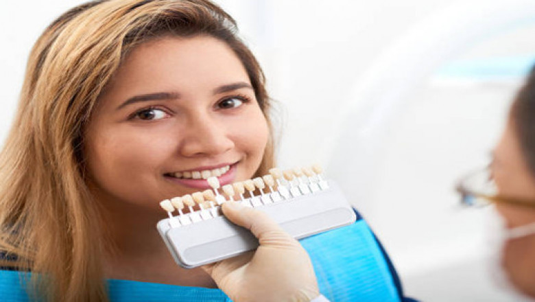 What Are Porcelain Veneers? A Complete Guide to Your Dream Smile