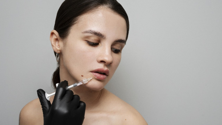 Lip Fillers Mississauga