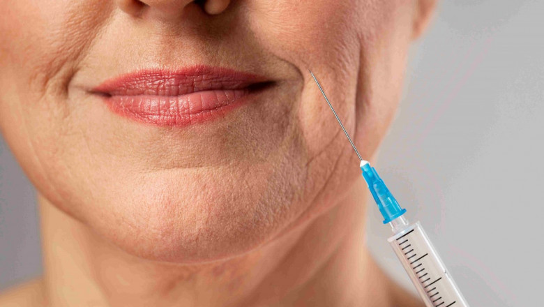 Dermal Fillers Oakville