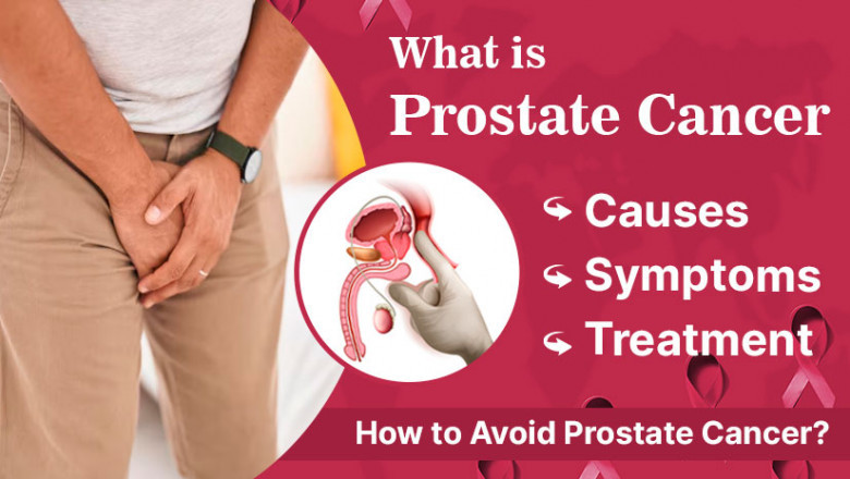 Understanding Prostate Cancer In Men’s Life: A Guide for Men