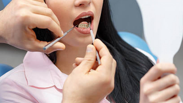 What Can Tooth Reshaping Fix? Small Chips, Uneven Edges, and More