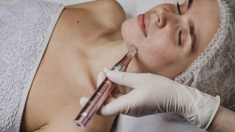 How to Choose Dermal Fillers in Mississauga
