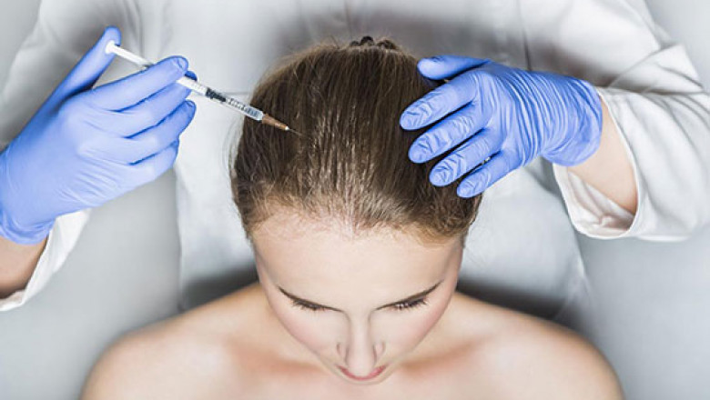 PRP Hair Treatment Dubai: How to Maintain Your Results After PRP Treatment