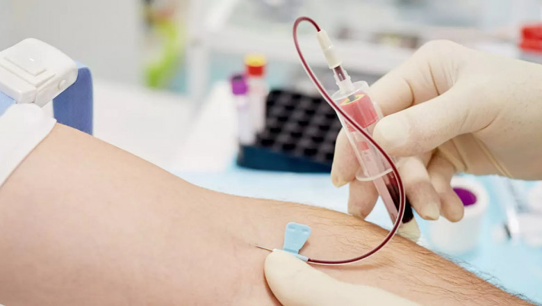 Serum Separation Gel Market