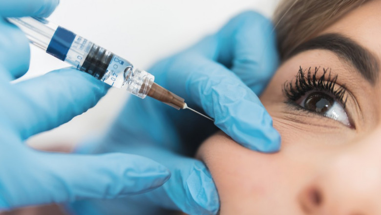 Trending Aesthetic Looks Achieved with Fillers