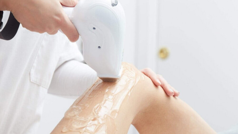 What Are the Side Effects of Laser Hair Removal in Islamabad?