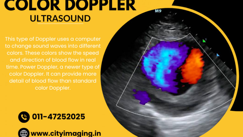 Know Colour Doppler Test Price Near You Today