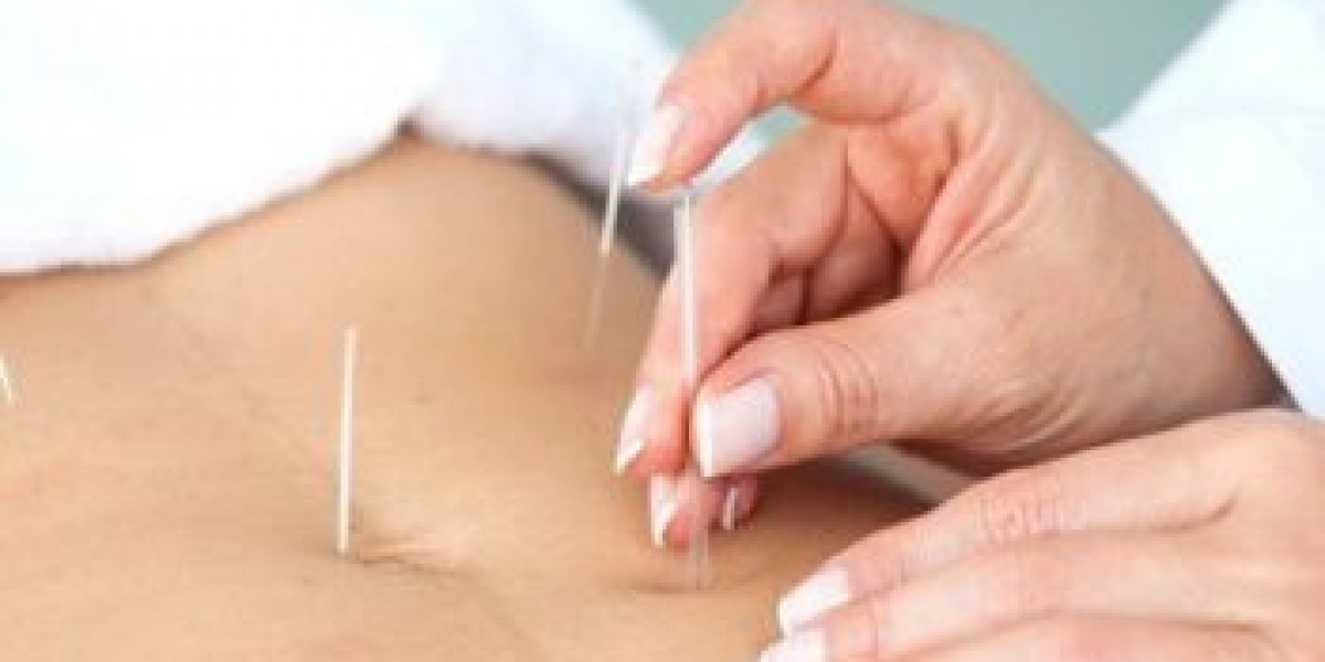 Best Fertility Acupuncture NYC