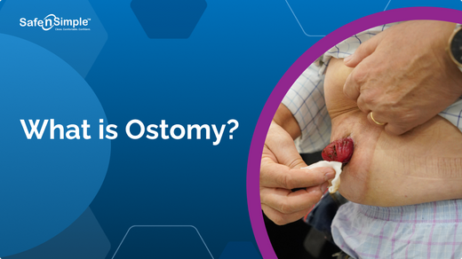 What is Ostomy  – SNS Medical