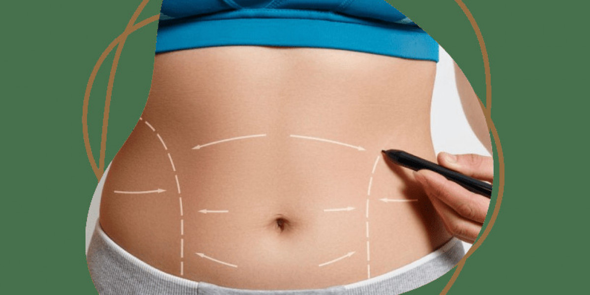 Which Liposuction Procedure Is Best for Targeted Body Contouring?