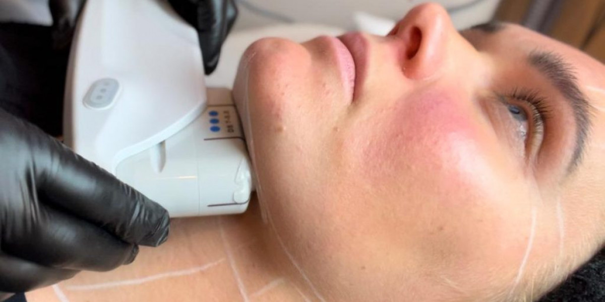 HIFU for Skin Tightening in Dubai: Real Results and Long-Term Benefits