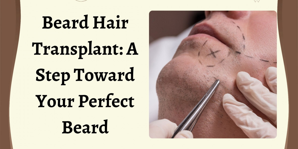 Beard Hair Transplant: A Step Toward Your Perfect Beard